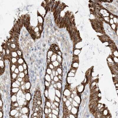 Immunohistochemistry-Paraffin: ETHE1 Antibody [NBP1-81690] - Staining of human colon shows high expression.