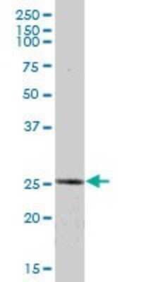Western Blot: ETHE1 Antibody [H00023474-B01P] - Analysis of ETHE1 expression in human liver.