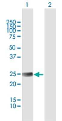 Western Blot: ETHE1 Antibody [H00023474-B01P] - Analysis of ETHE1 expression in transfected 293T cell line by ETHE1 polyclonal antibody.  Lane 1: ETHE1 transfected lysate(27.94 KDa). Lane 2: Non-transfected lysate.