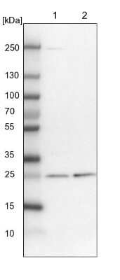 Western Blot: ETHE1 Antibody [NBP1-81689] - Lane 1: NIH-3T3 cell lysate (Mouse embryonic fibroblast cells). Lane 2: NBT-II cell lysate (Rat Wistar bladder tumor cells).