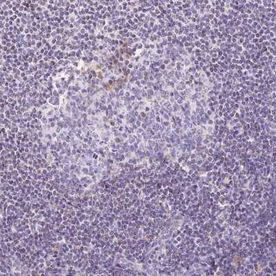 <b>Orthogonal Strategies Validation. </b>Immunohistochemistry-Paraffin: ETNK2 Antibody [NBP2-49248] - Staining of human lymph node shows low expression as expected.