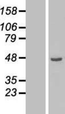 Western Blot ETNK2 Overexpression Lysate