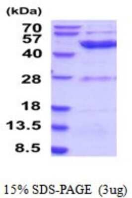SDS-PAGE Recombinant Human ETNK2 His Protein