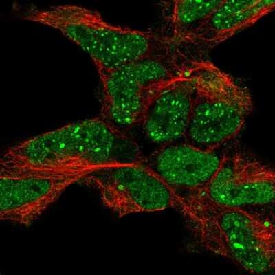 Immunocytochemistry/Immunofluorescence: ETS1 associated protein II Antibody [NBP2-55948] - Staining of human cell line HEK 293 shows localization to nucleoplasm, nuclear bodies & aggresome.