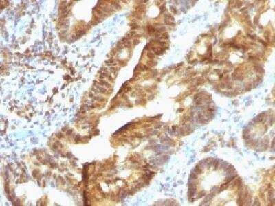 Immunohistochemistry-Paraffin ETS1 associated protein II Antibody (TDP2/1258)