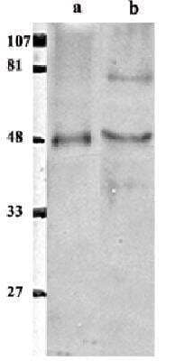 Western Blot ETS1 associated protein II Antibody - BSA Free