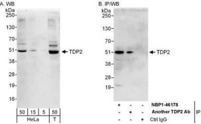 Western Blot ETS1 associated protein II Antibody