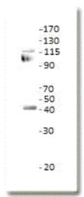 Western Blot: ETS1 associated protein II Antibody [NBP2-11491] - Analysis using the FITC conjugate of NBP2-11491. Detection of antibody dilution 1:1000 in diluObuffer. Apparent MW is 39 kDa.