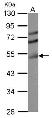 Western Blot: ETS1 associated protein II Antibody [NBP2-16386] - Sample (30 ug of whole cell lysate) A: HCT116 10% SDS PAGE gel, diluted at 1:3000.