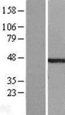 Western Blot: ETS1 associated protein II Overexpression Lysate (Adult Normal) [NBL1-17424] Left-Empty vector transfected control cell lysate (HEK293 cell lysate); Right -Over-expression Lysate for ETS1 associated protein II.