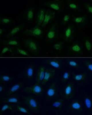 Immunocytochemistry/Immunofluorescence: ETS2 Antibody [NBP3-04749] - Analysis of U-2 OS cells using ETS2 antibody at dilution of 1:100. Blue: DAPI for nuclear staining.