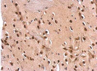 Immunohistochemistry-Paraffin: ETS2 Antibody [NBP2-14951] -  Rat fore brain. ETS2 antibody dilution: 1:500. Antigen Retrieval: Trilogy™ (EDTA based, pH 8.0) buffer, 15min. 