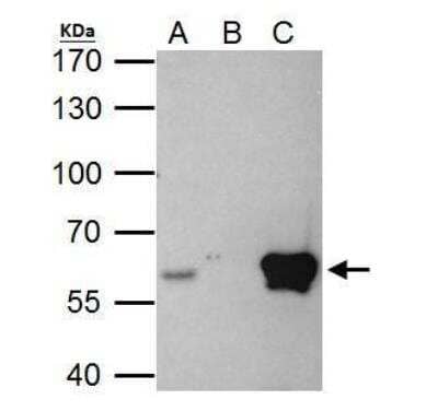 Immunoprecipitation: ETS2 Antibody [NBP2-14951] - HeLa whole cell lysate/extract A. 40 ug HeLa whole cell lysate/extract B. Control with 2 ug of preimmune rabbit IgG C. Immunoprecipitation of ETS2 protein by 2 ug of ETS2 antibody 7.5% SDS-PAGE The immunoprecipitated ETS2 protein was detected by ETS2 antibody diluted at 1:1000. EasyBlot anti-rabbit IgG was used as a secondary reagent.