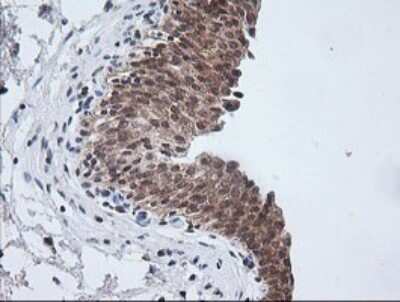 Immunohistochemistry: ETS2 Antibody (OTI2A3) [NBP2-45543] - Analysis of Human bladder tissue.