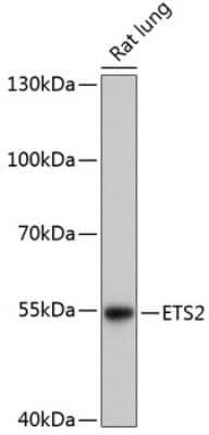 Western Blot: ETS2 Antibody [NBP3-04763] - Analysis of extracts of Rat lung, using ETS2 antibody at 1:3000 dilution. Secondary antibody: HRP Goat Anti-Rabbit IgG (H+L) at 1:10000 dilution. Lysates/proteins: 25ug per lane. Blocking buffer: 3% nonfat dry milk in TBST. Detection: ECL Enhanced Kit .