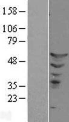 Western Blot ETS2 Overexpression Lysate