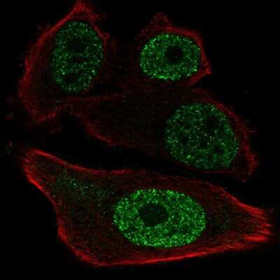 Immunocytochemistry/Immunofluorescence: ETV1 Antibody [NBP2-57731] - Staining of human cell line PC-3 shows localization to nucleoplasm. Antibody staining is shown in green.