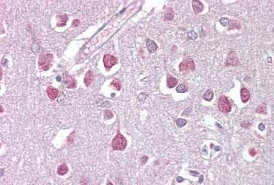 Immunohistochemistry ETV1 Antibody