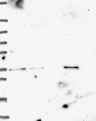 Western Blot: ETV1 Antibody [NBP3-17710] - Lane 1: Marker [kDa] 250, 130, 95, 72, 55, 36, 28, 17, 10;   Lane 2: RT4;   Lane 3: U-251 MG;   Lane 4: Human Plasma;   Lane 5: Liver;   Lane 6: Tonsil