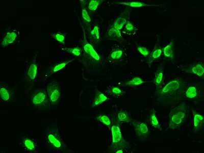 Immunocytochemistry/Immunofluorescence: ETV3 Antibody [NBP2-98676] - Immunofluorescence staining of ETV3 in U251MG cells. Cells were fixed with 4% PFA, permeabilzed with 0.1% Triton X-100 in PBS, blocked with 10% serum, and incubated with rabbit anti-Human ETV3 polyclonal antibody (dilution ratio 1:200) at 4C overnight. Then cells were stained with the Alexa Fluor(R)488-conjugated Goat Anti-rabbit IgG secondary antibody (green). Positive staining was localized to Nucleus.