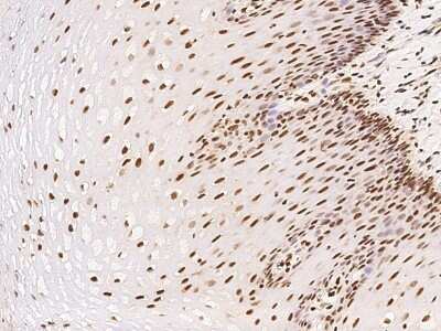 Immunohistochemistry-Paraffin: ETV3 Antibody [NBP2-98676] - Immunochemical staining of human ETV3 in human esophagus with rabbit polyclonal antibody at 1:100 dilution, formalin-fixed paraffin embedded sections.