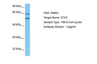 Western Blot: ETV3 Antibody [NBP2-84872] - Host: Rabbit. Target Name: ETV3. Sample Tissue: Human 786-0 Whole Cell lysates. Antibody Dilution: 1ug/ml