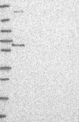 Western Blot: ETV3 Antibody [NBP3-17841] - Lane 1: Marker [kDa] 250, 130, 95, 72, 55, 36, 28, 17, 10;   Lane 2: RT4;   Lane 3: U-251 MG;   Lane 4: Human Plasma;   Lane 5: Liver;   Lane 6: Tonsil