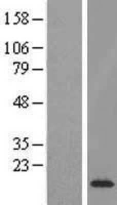 Western Blot: ETV3 Overexpression Lysate (Adult Normal) [NBL1-10358] Left-Empty vector transfected control cell lysate (HEK293 cell lysate); Right -Over-expression Lysate for ETV3.