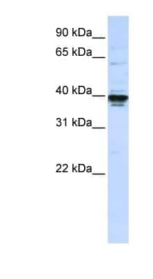 Western Blot ETV3L Antibody - BSA Free