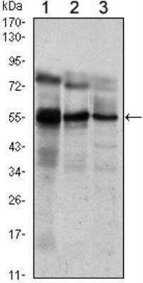Western Blot: ETV5/ERM Antibody (3H3) [NBP1-51614] - Analysis using ETV5 mouse mAb against Jurkat (1), NIH/3T3 (2) and MCF-7 (3) cell lysate.