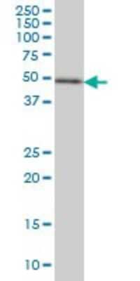 Western Blot: ETV5/ERM Antibody (7C10) [H00002119-M02] - ETV5 monoclonal antibody (M02), clone 7C10 Analysis of ETV5 expression in Hela S3 NE.