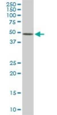 Western Blot: ETV5/ERM Antibody (7C10) [H00002119-M02] - ETV5 monoclonal antibody (M02), clone 7C10. Analysis of ETV5 expression in Raw 264.7.