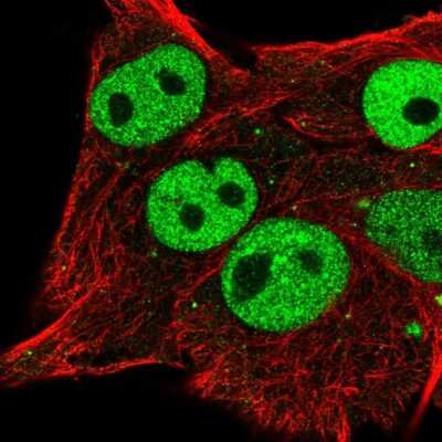 Immunocytochemistry/Immunofluorescence: ETV5/ERM Antibody [NBP2-55689] - Staining of human cell line SK-MEL-30 shows localization to nucleoplasm.