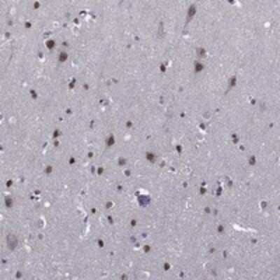 Immunohistochemistry-Paraffin: ETV5/ERM Antibody [NBP3-17656] - Staining of human cerebral cortex shows strong nuclear positivity in neuronal cells and glial cells.