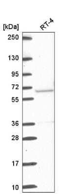 Western Blot: ETV5/ERM Antibody [NBP2-55689] - Analysis in human cell line RT-4.