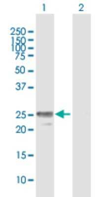 Western Blot: EVA1/MPZL2 Antibody [H00010205-B01P] - Analysis of MPZL2 expression in transfected 293T cell line by MPZL2 polyclonal antibody.  Lane 1: MPZL2 transfected lysate(23.65 KDa). Lane 2: Non-transfected lysate.