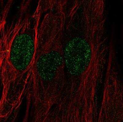 Immunocytochemistry/Immunofluorescence: EVG1 Antibody [NBP2-76489] -  Staining of human cell line BJ shows localization to nucleus. Antibody staining is shown in green.
