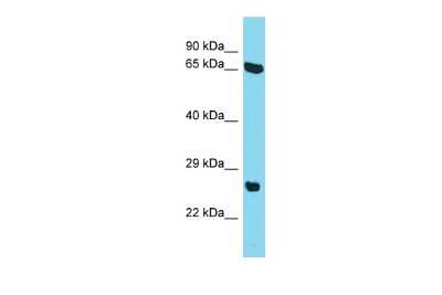 Western Blot: EVG1 Antibody [NBP2-83023] - Host: Rabbit. Target Name: C22orf23. Sample Type: HepG2 Whole Cell lysates. Antibody Dilution: 1.0ug/ml