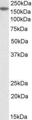 Western Blot: EVI-1 Antibody [NBP1-52024] - (2ug/ml) staining of A549 lysate (35ug protein in RIPA buffer). Primary incubation was 1 hour. Detected by chemiluminescence.