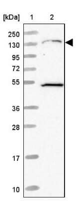 Western Blot: EVI-1 Antibody [NBP2-48848] - Lane 1: Marker [kDa] 250, 130, 95, 72, 55, 36, 28, 17, 10&lt;br/&gt;Lane 2: Human cell line RT-4