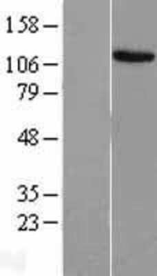 Western Blot: EVI1 Overexpression Lysate (Adult Normal) [NBL1-10364] Left-Empty vector transfected control cell lysate (HEK293 cell lysate); Right -Over-expression Lysate for EVI1.