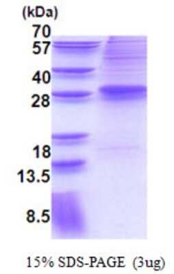 SDS-Page: EVI1 Protein [NBP2-22647]