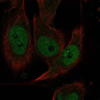 Immunocytochemistry/ Immunofluorescence EVI2A Antibody - BSA Free