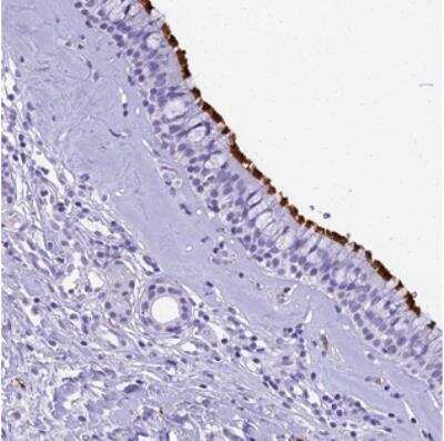 Immunohistochemistry EVI2A Antibody - BSA Free