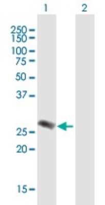Western Blot EVI2A Antibody - Azide and BSA Free