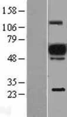 Western Blot: EVI2A Overexpression Lysate (Adult Normal) [NBL1-10365] Left-Empty vector transfected control cell lysate (HEK293 cell lysate); Right -Over-expression Lysate for EVI2A.