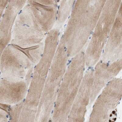Immunohistochemistry-Paraffin: EVI2B Antibody [NBP1-85342] - Staining of human skeletal muscle shows low expression as expected.