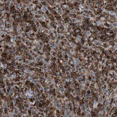 Immunohistochemistry-Paraffin: EVI2B Antibody [NBP1-85342] - Staining of human spleen shows high expression.