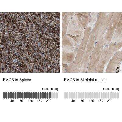 Immunohistochemistry-Paraffin: EVI2B Antibody [NBP1-85342] - Staining in human spleen and skeletal muscle tissues using anti-EVI2B antibody. Corresponding EVI2B RNA-seq data are presented for the same tissues.