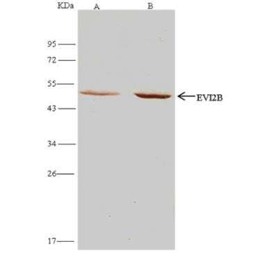 Immunoprecipitation: EVI2B Antibody [NBP2-99056] - Lane A:0.5 mg Hela Whole Cell LysateLane B:0.5 mg Jurkat Whole Cell Lysate1 uL anti-EVI2B rabbit polyclonal antibody and 15 ul of 50 % Protein G agarose.Primary antibody:Anti-EVI2B rabbit polyclonal antibody,at 1:500 dilution Secondary antibody:Clean-Bloto IP Detection Reagent (HRP) at 1:500 dilution Developed using the DAB staining technique.Performed under reducing conditions.Predicted band size: 49 kDaObserved band size: 49 kDa
